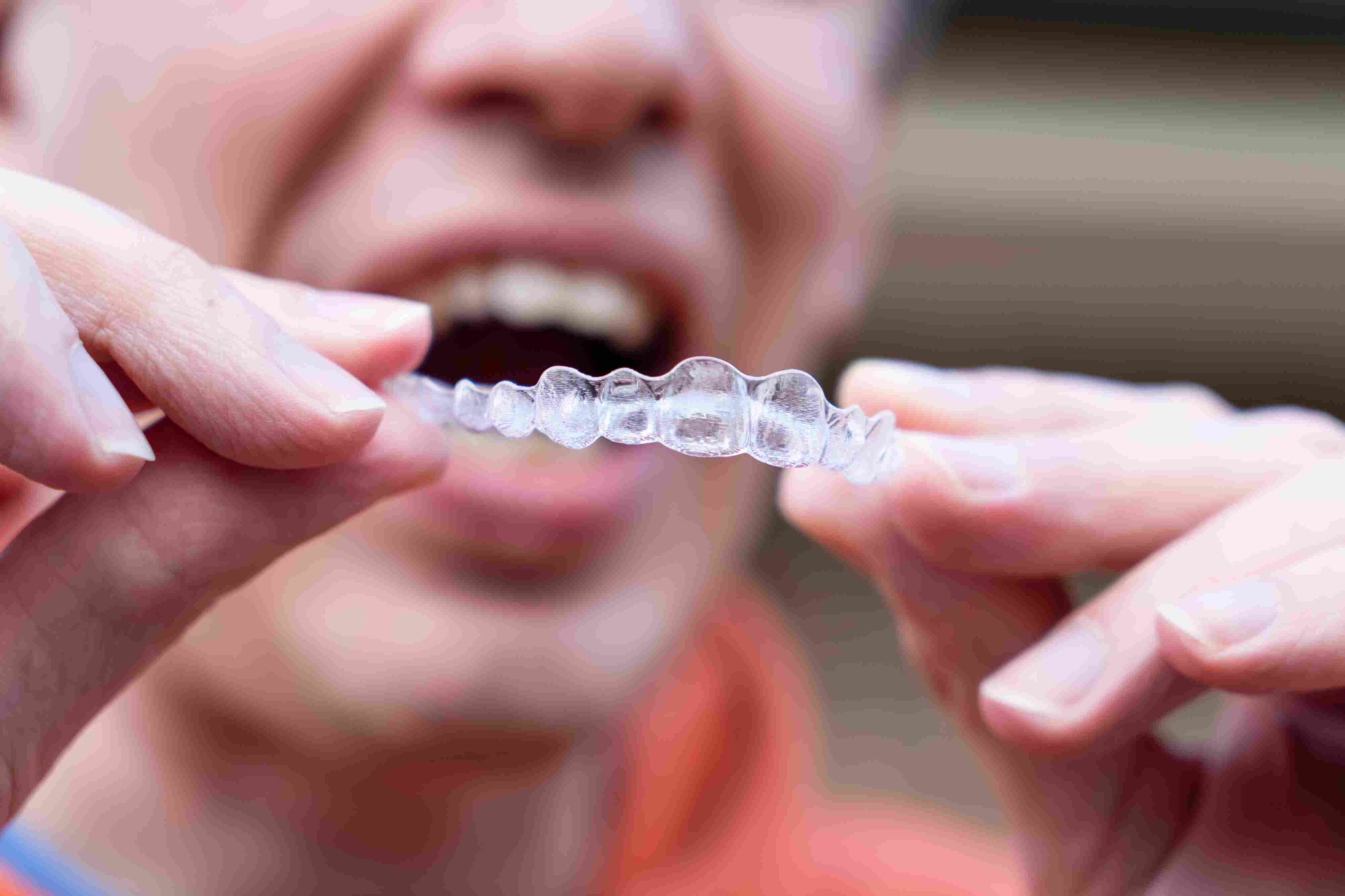 Person holder en gjennomsiktig Invisalign-skinne foran tennene